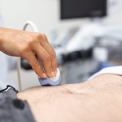 Ultrasound diagnosis of the stomach on the abdominal cavity of a man in the clinic, close-up view. The doctor runs an ultrasound sensor over the patient's male abdomen. Diagnostics of internal organs.
