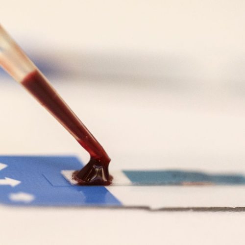 Teste de HIV